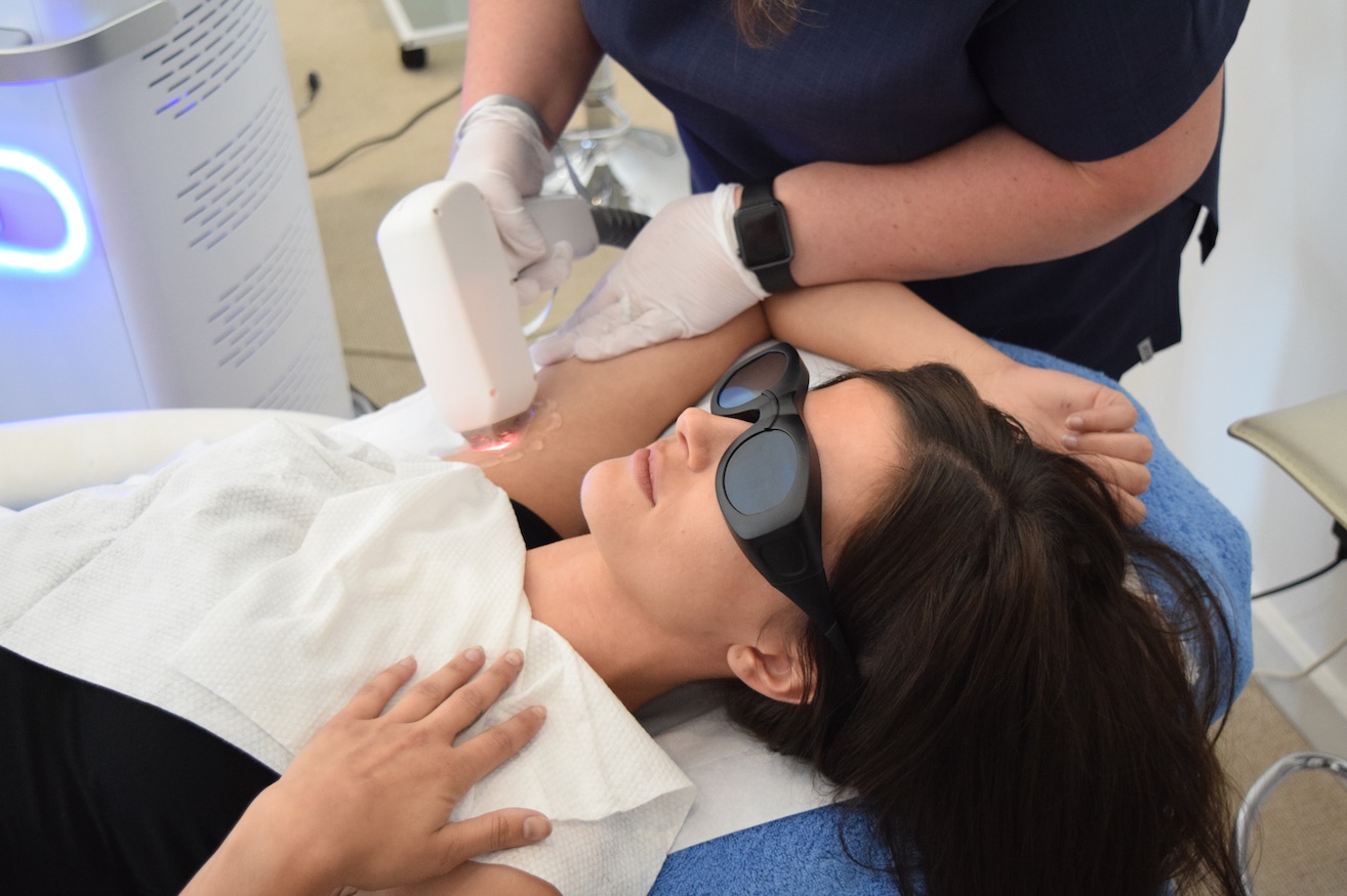 Laser Hair Removal Treatment